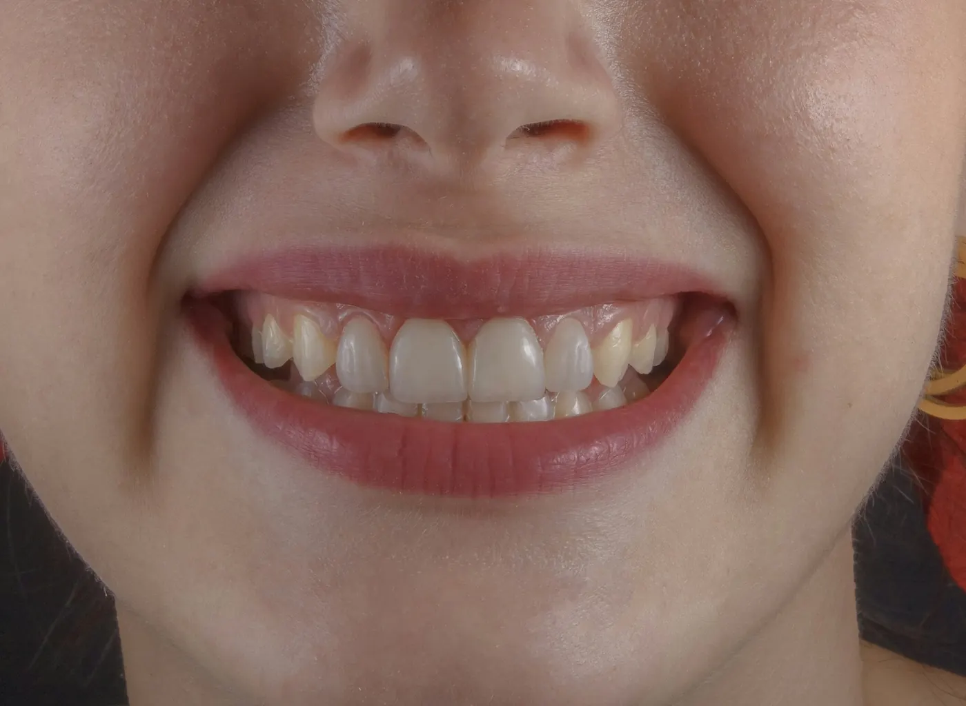 Close-up of a bright, natural smile